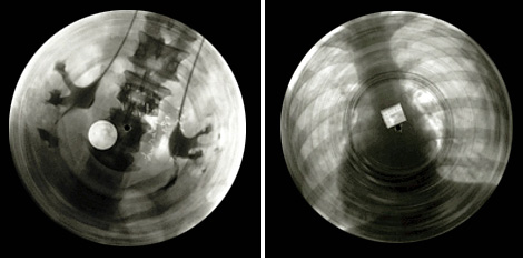 Disques gravés sur des radios récupérées dans les hôpitaux soviétiques.